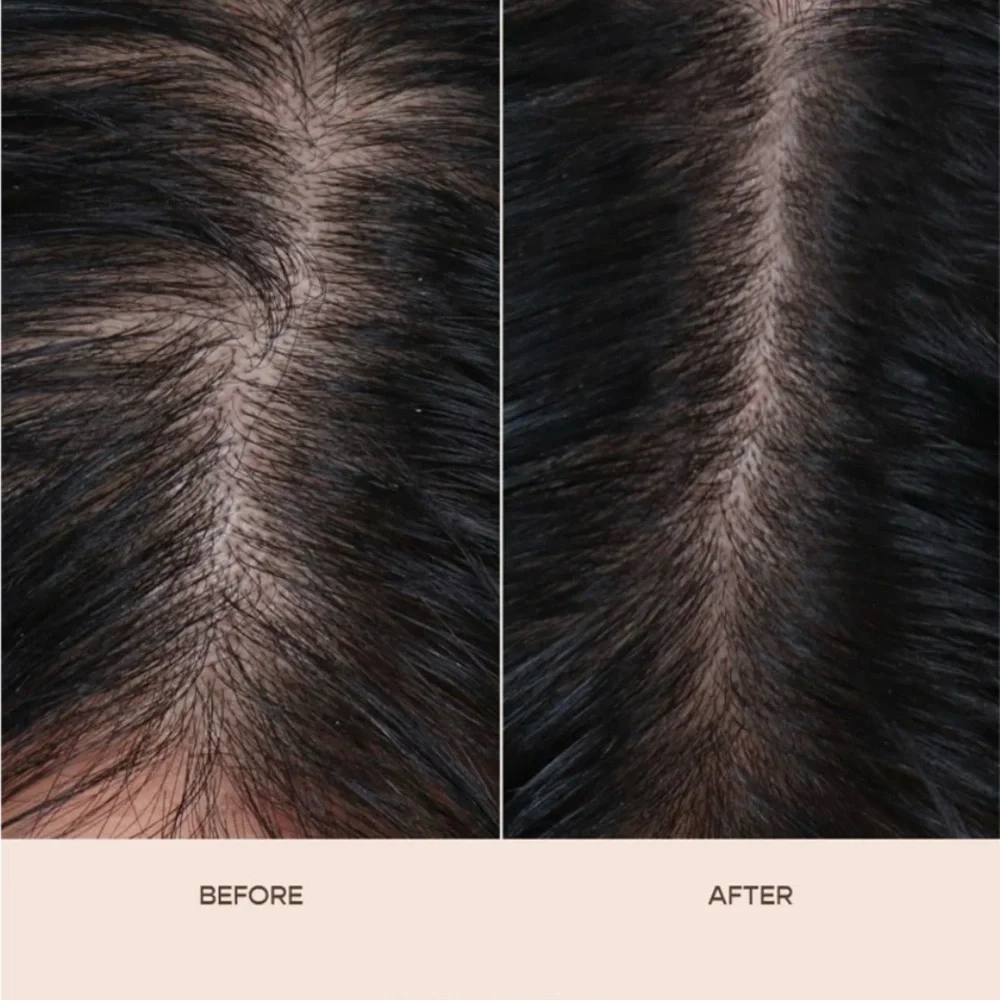GRO Hair Serum - Pink - Picture 5 of 7